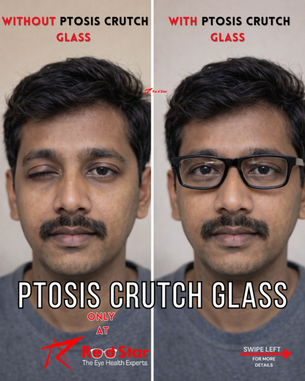 Ptosis glasses Ptosis Crutch Glass